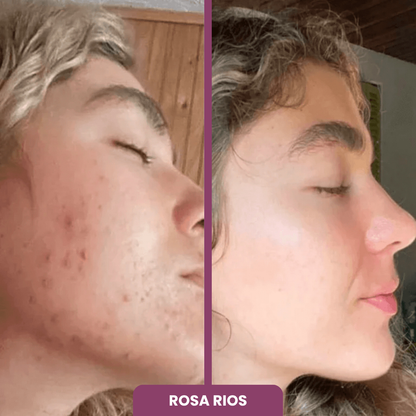 2x1 BÁLSAMO + 10 MASCARILLAS GRATIS