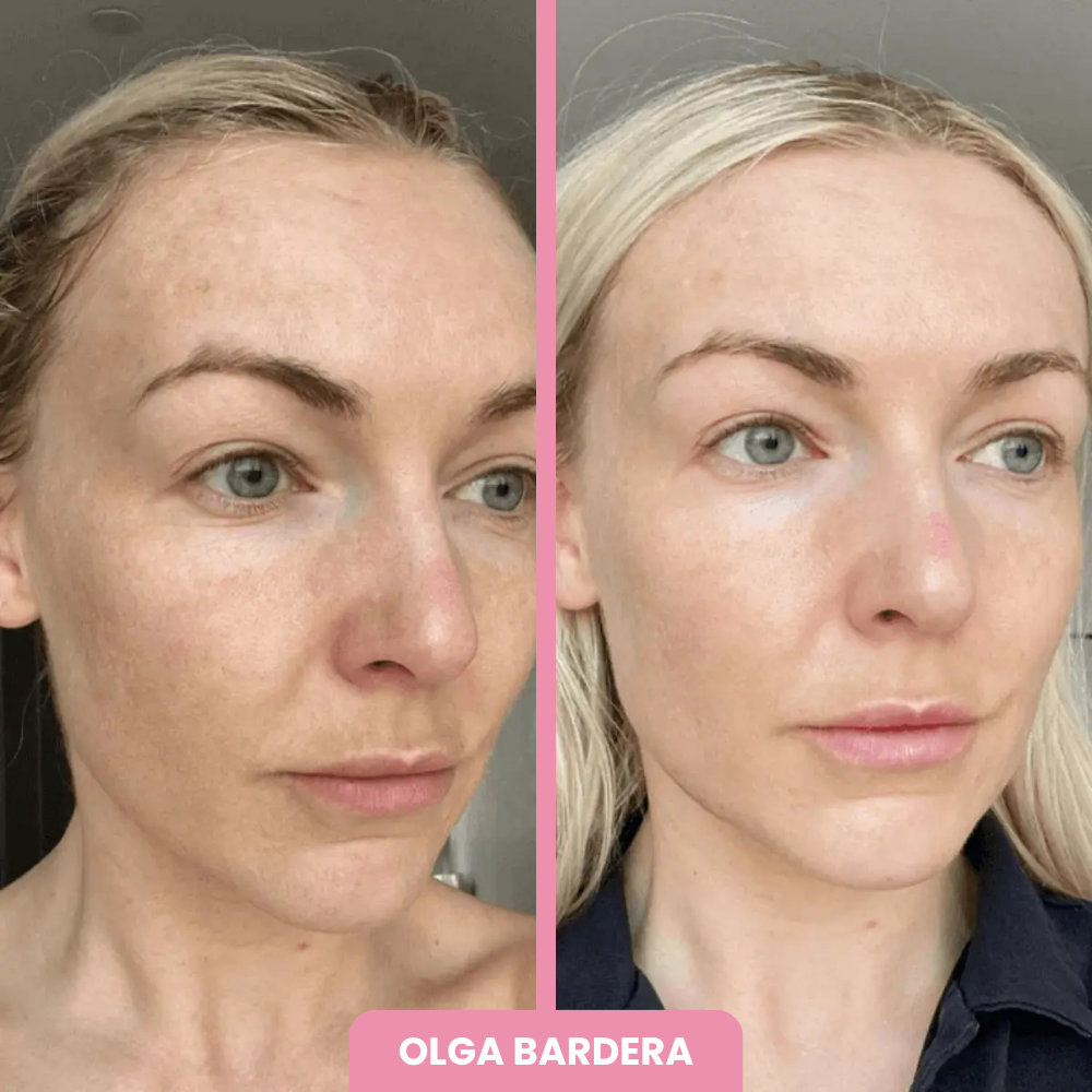 OFERTA 2x1 + BROCHA REGALO | Máscara de Colágeno Coreana 🇰🇷