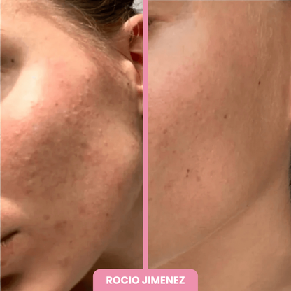 OFERTA 2x1 + BROCHA REGALO | Máscara de Colágeno Coreana 🇰🇷